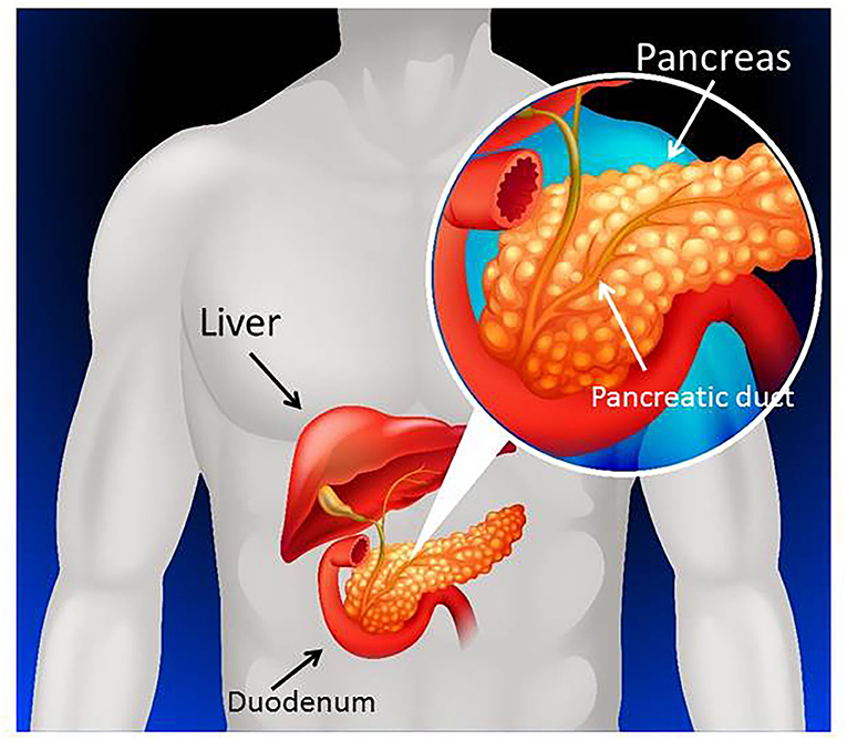 Figure 1 - The pancreas is located next to the stomach, liver, and small intestine.