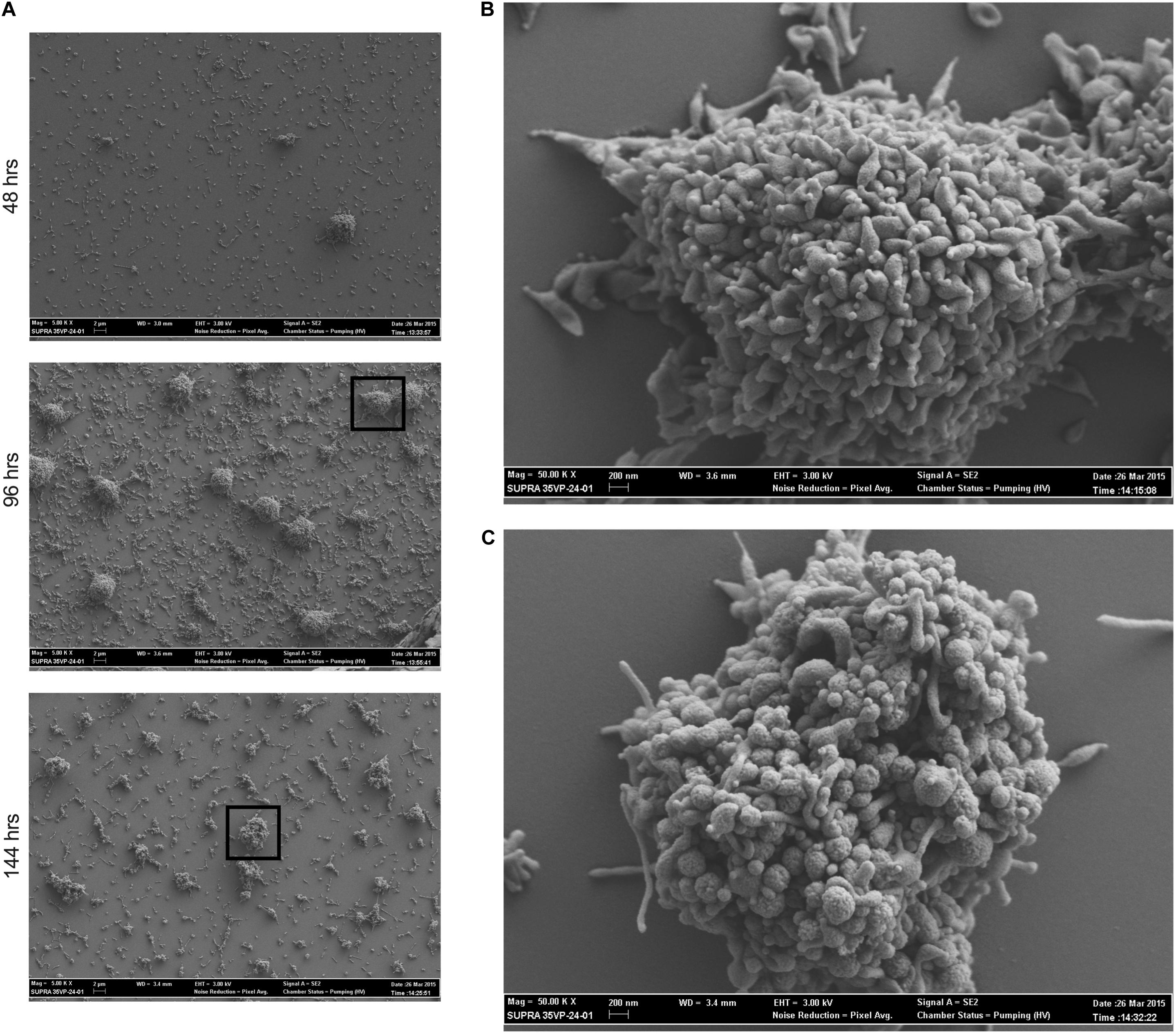 tratamentul prostatitei cu ghimbir calcifiere prostata cauze