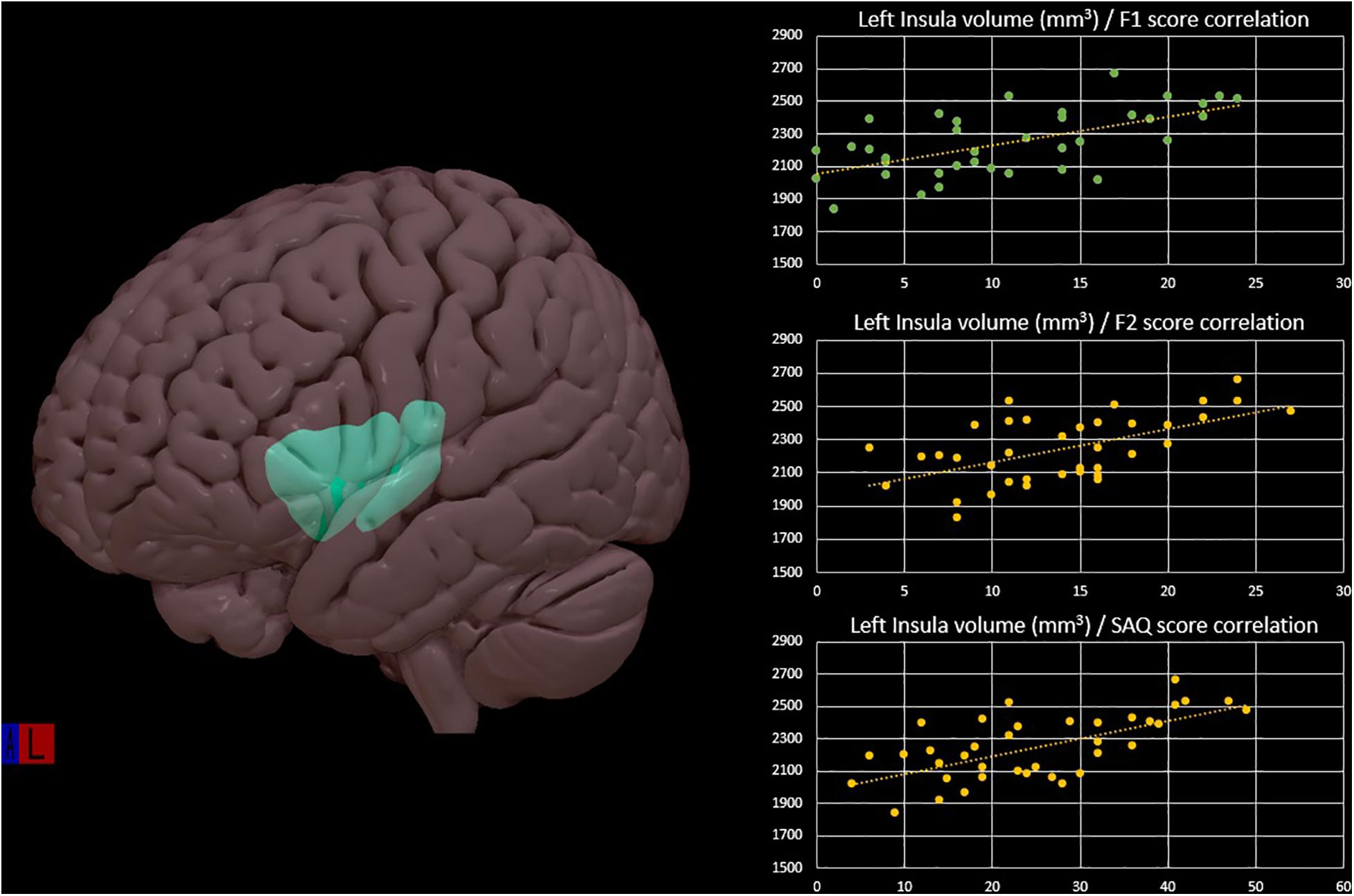 Paul brain. Insular Cortex. Subcortical structures of the Brain. Головной мозг по полям. Insula Brain.