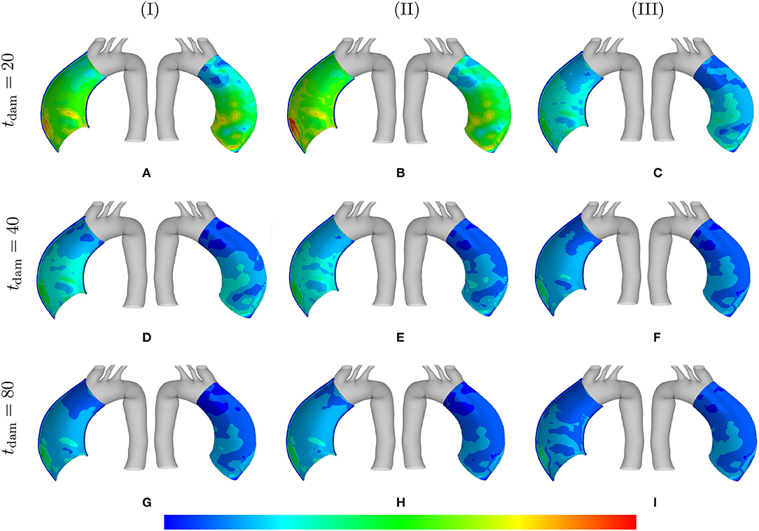 helix piercing - Wikidata