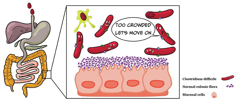 Figure 2 - The normal colonic flora is composed of billions of microorganisms (purple).