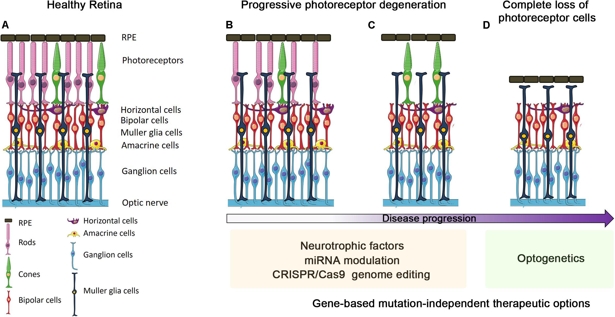 Retina - Gene Vision