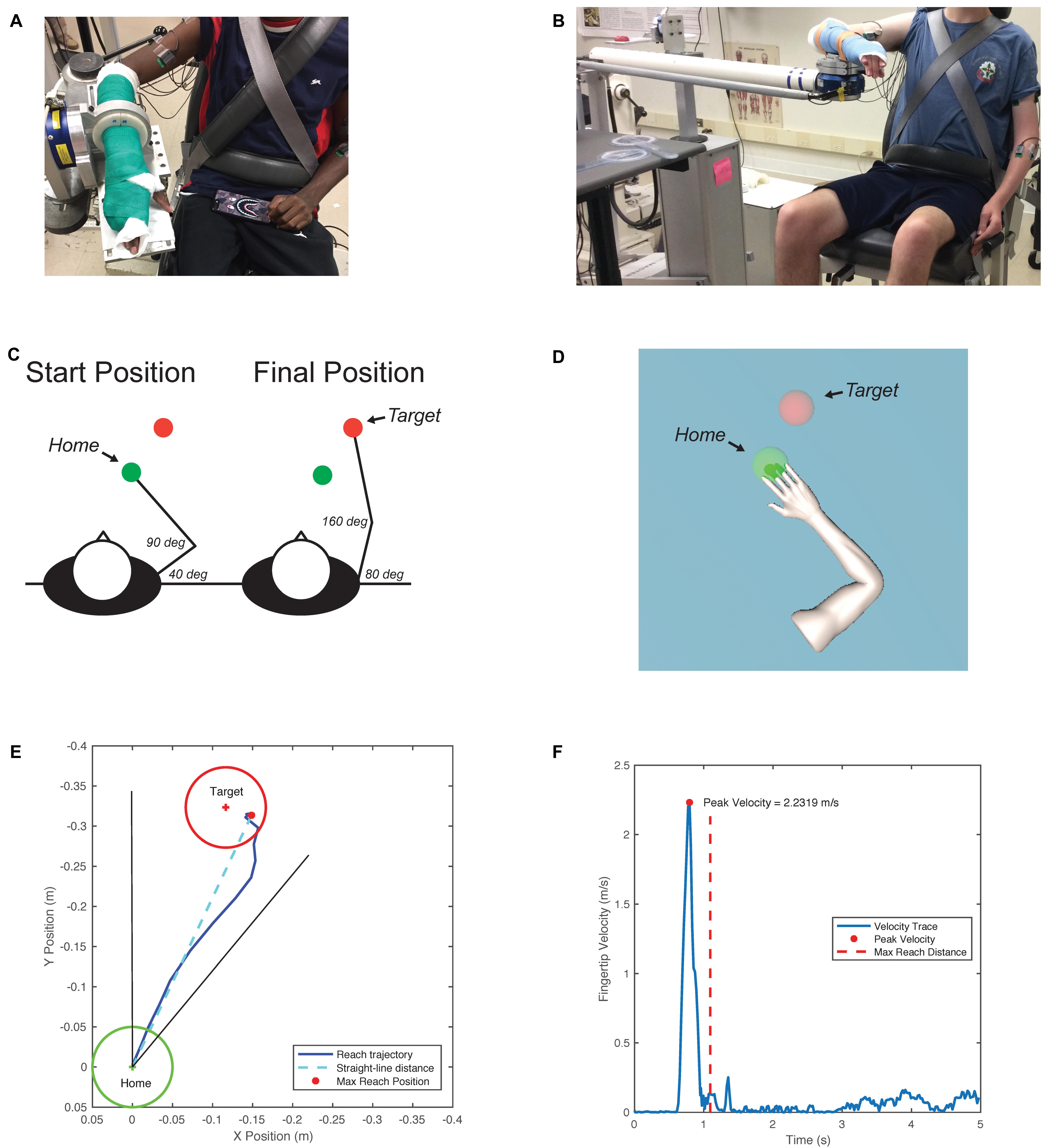 Frontiers The Upper Extremity Flexion Synergy Is Minimally Expressed