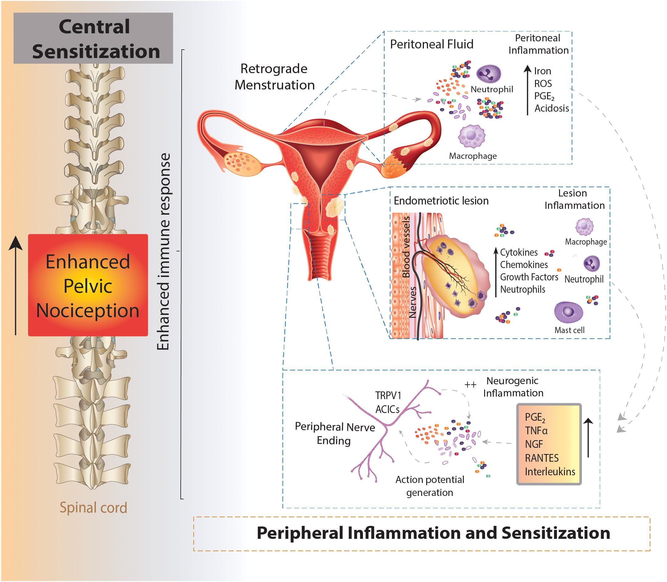 Natural Endometriosis Pain Relief: Holistic Approach & Functional