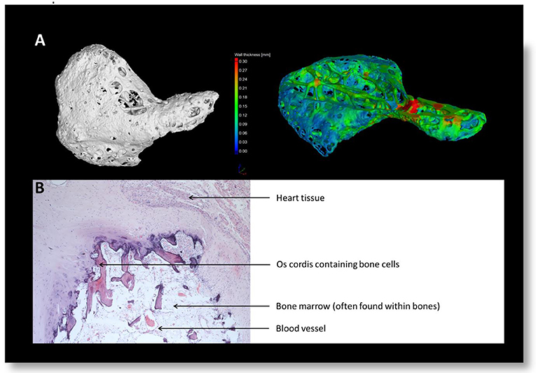 Figure 3 - Images of the os cordis.