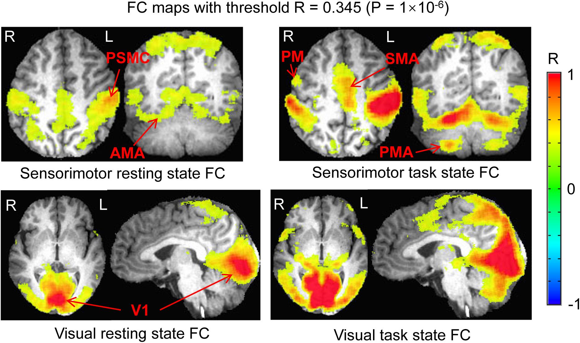 Frontiers  The Relationship of Functional Connectivity of the