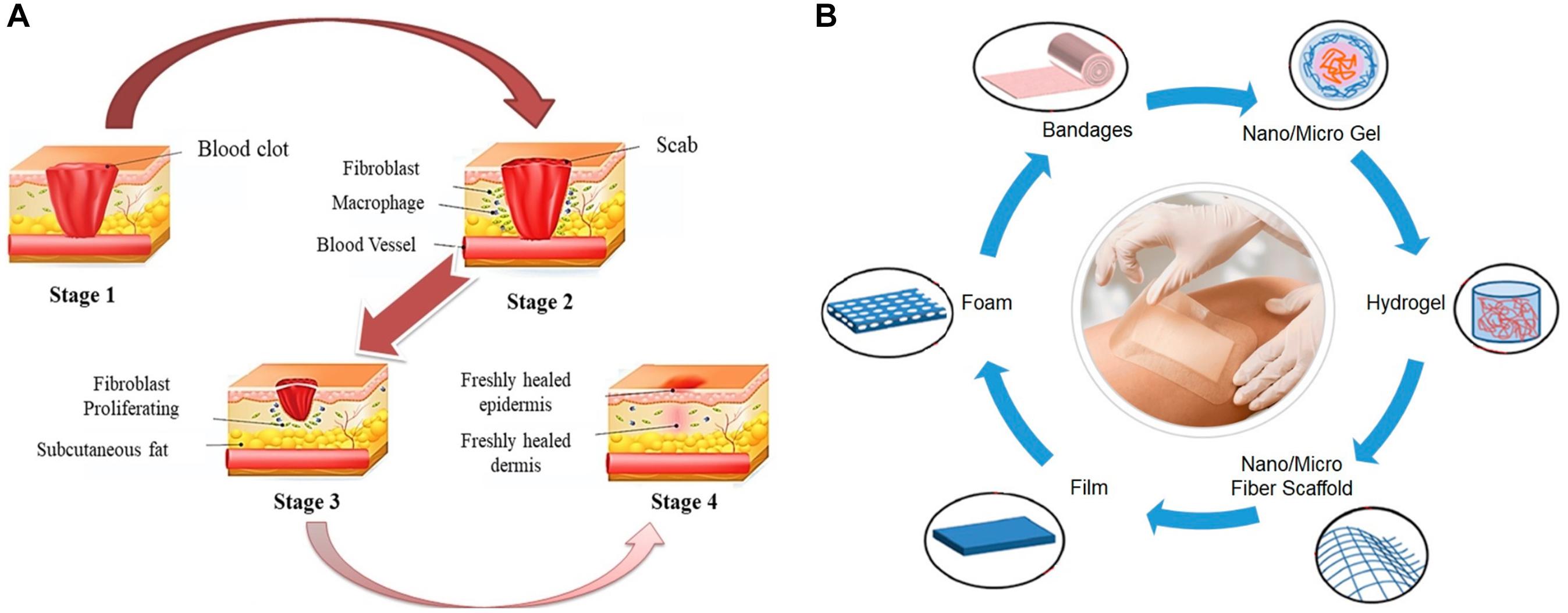 parfüm Naylon baş ağrısı bacterial cellulose wound dressing genel bakış ...