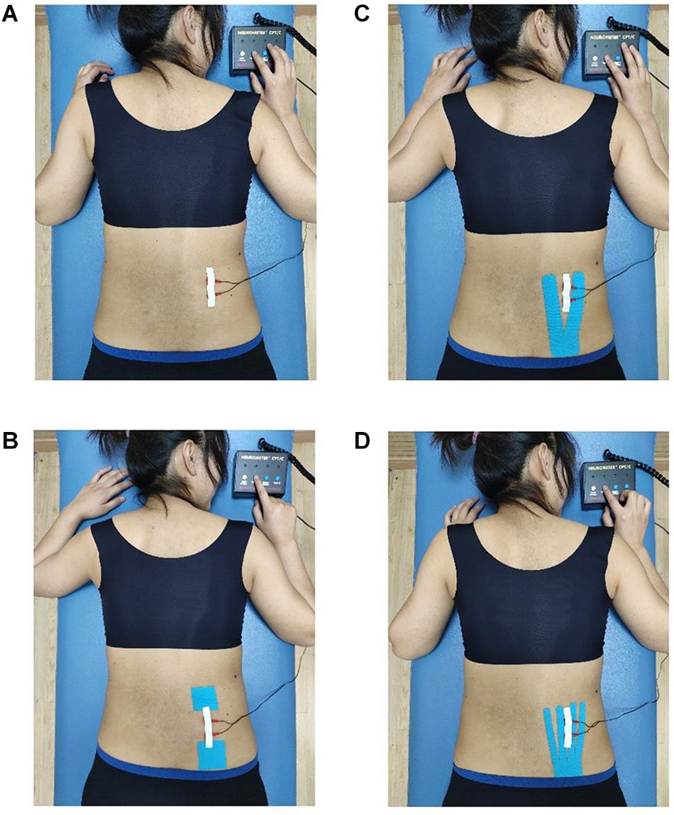 Frontiers  Effect of Different Kinesio Taping Interventions on the Local  Thresholds of Current Perception and Pressure Pain in Healthy Adults