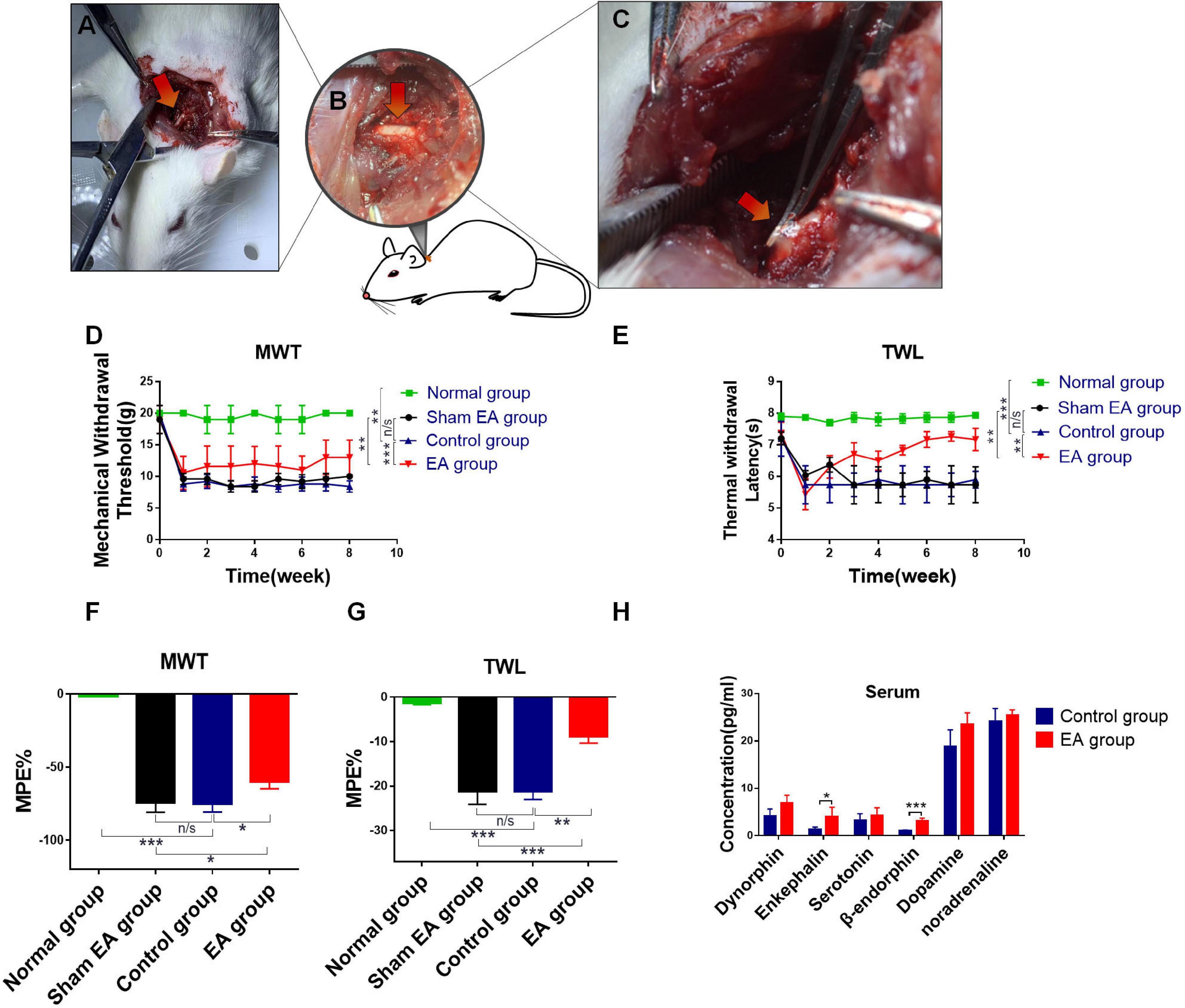 Frontiers  Pain Relief Dependent on IL-17–CD4+ T Cell–β-Endorphin