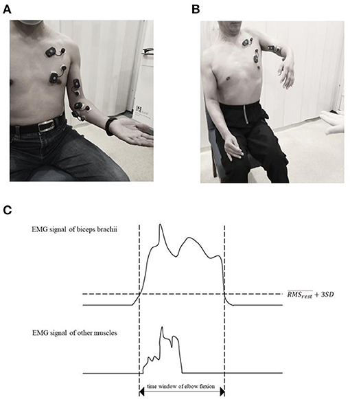 Frontiers The Muscle Activation Differences in PostStroke Upper Limb