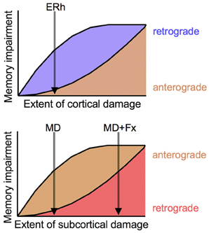 Focal retrograde amnesia Focal retrograde amnesia