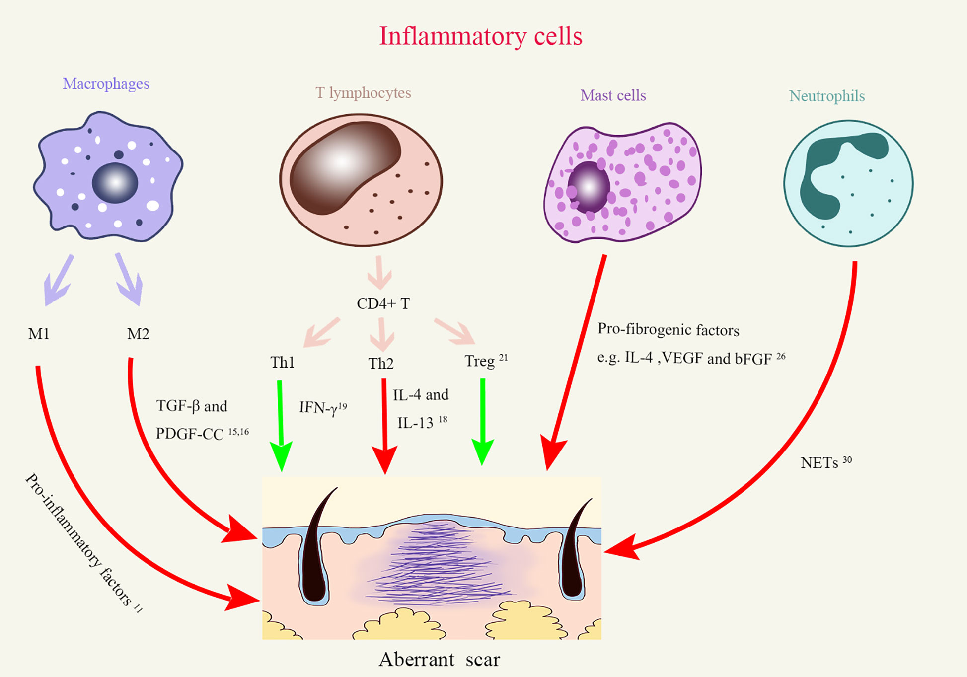 Frontiers  The Roles of Inflammation in Keloid and Hypertrophic Scars
