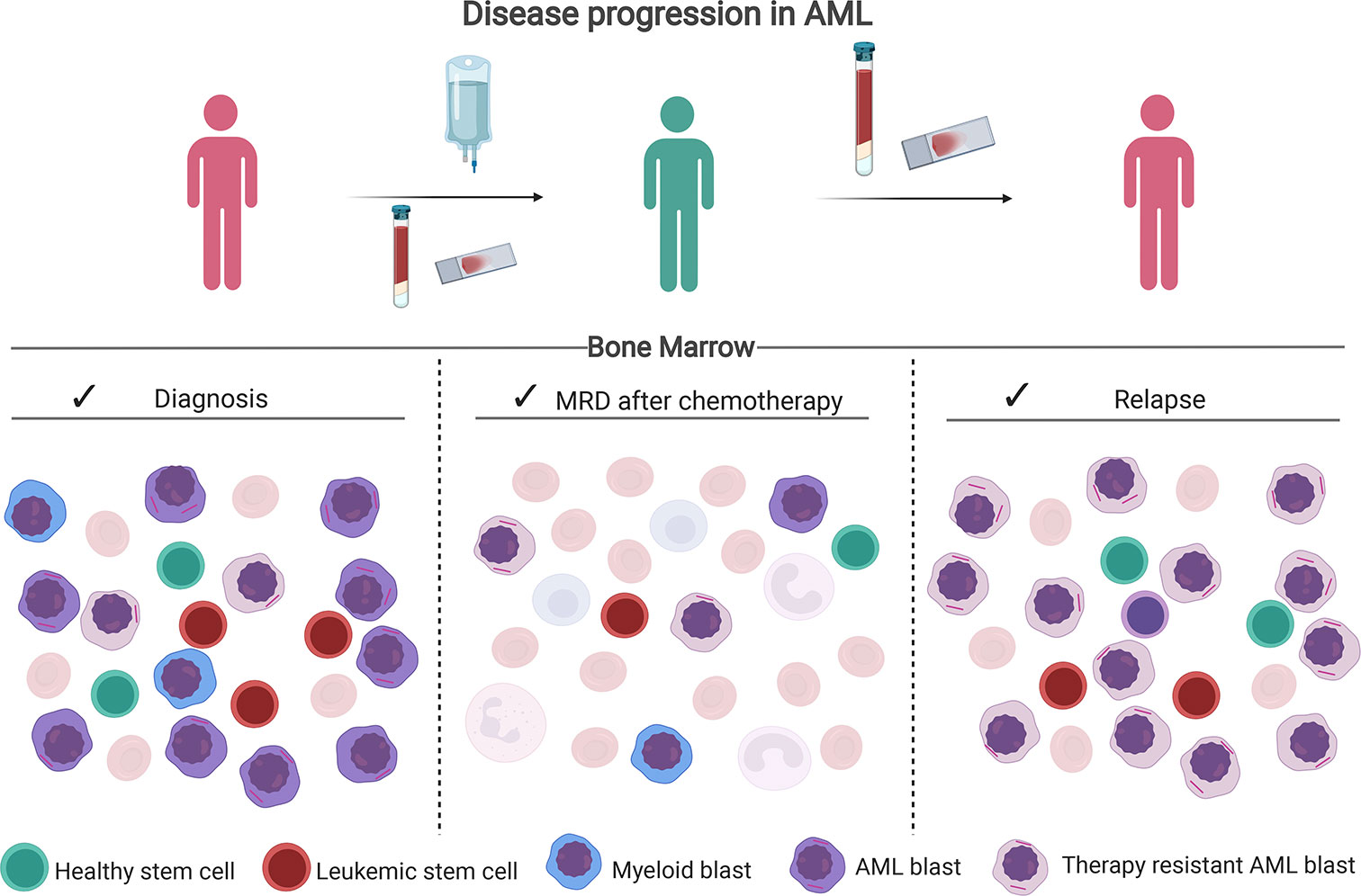 What Happens At The End Of Acute Myeloid Leukemia Insights Into Recovery