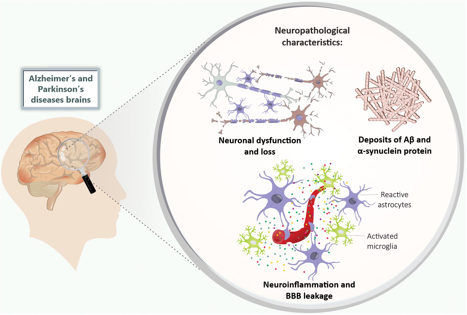 Frontiers | Animal Models of Metabolic Disorders in the Study of ...