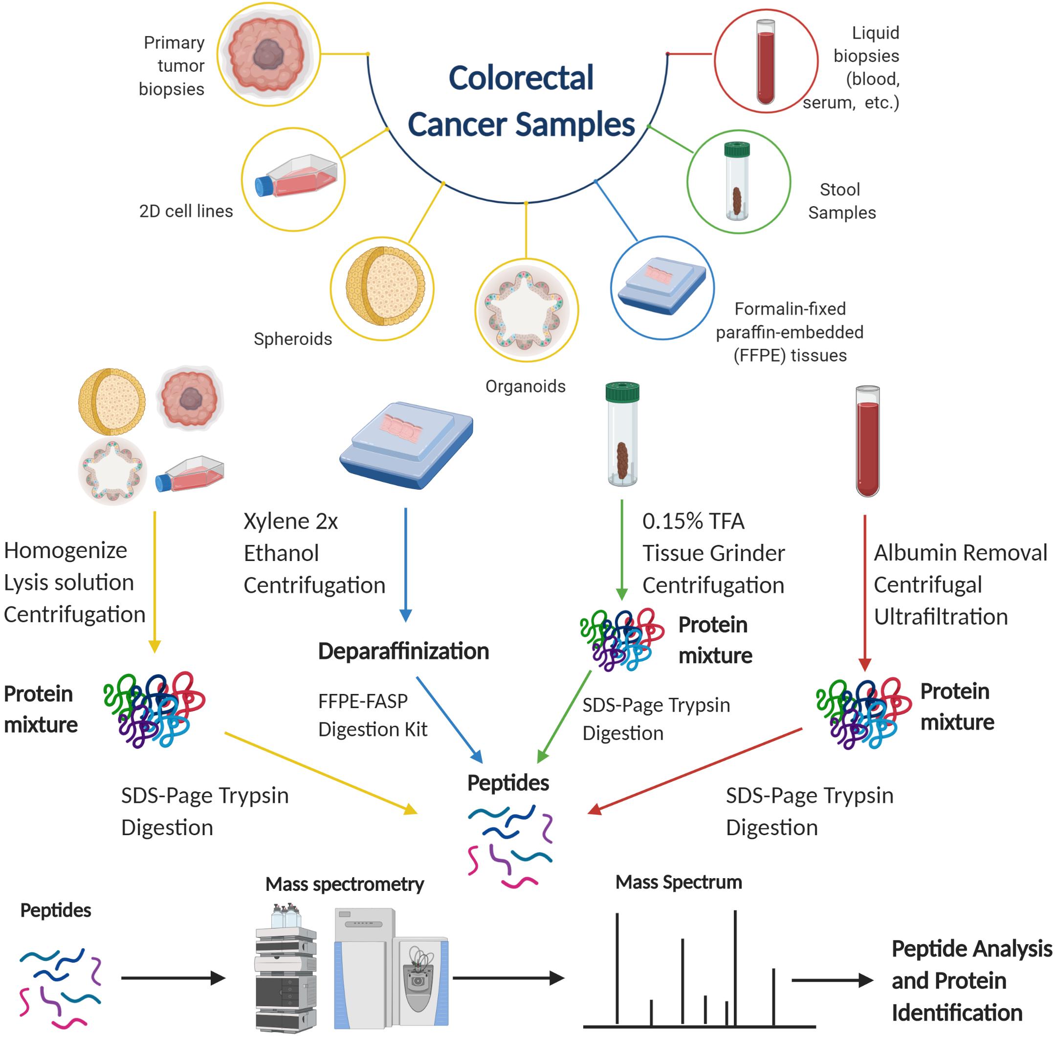 colorectal cancer overview