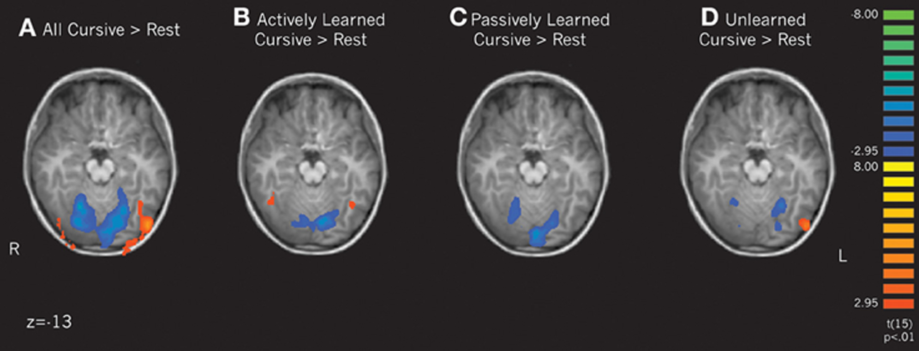 Frontiers  Brain activation patterns resulting from learning