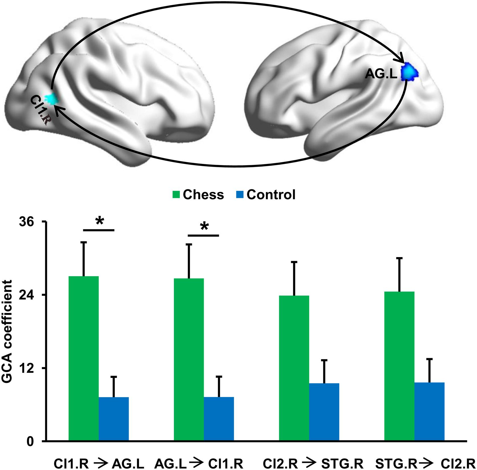 Pattern of focal γ-bursts in chess players