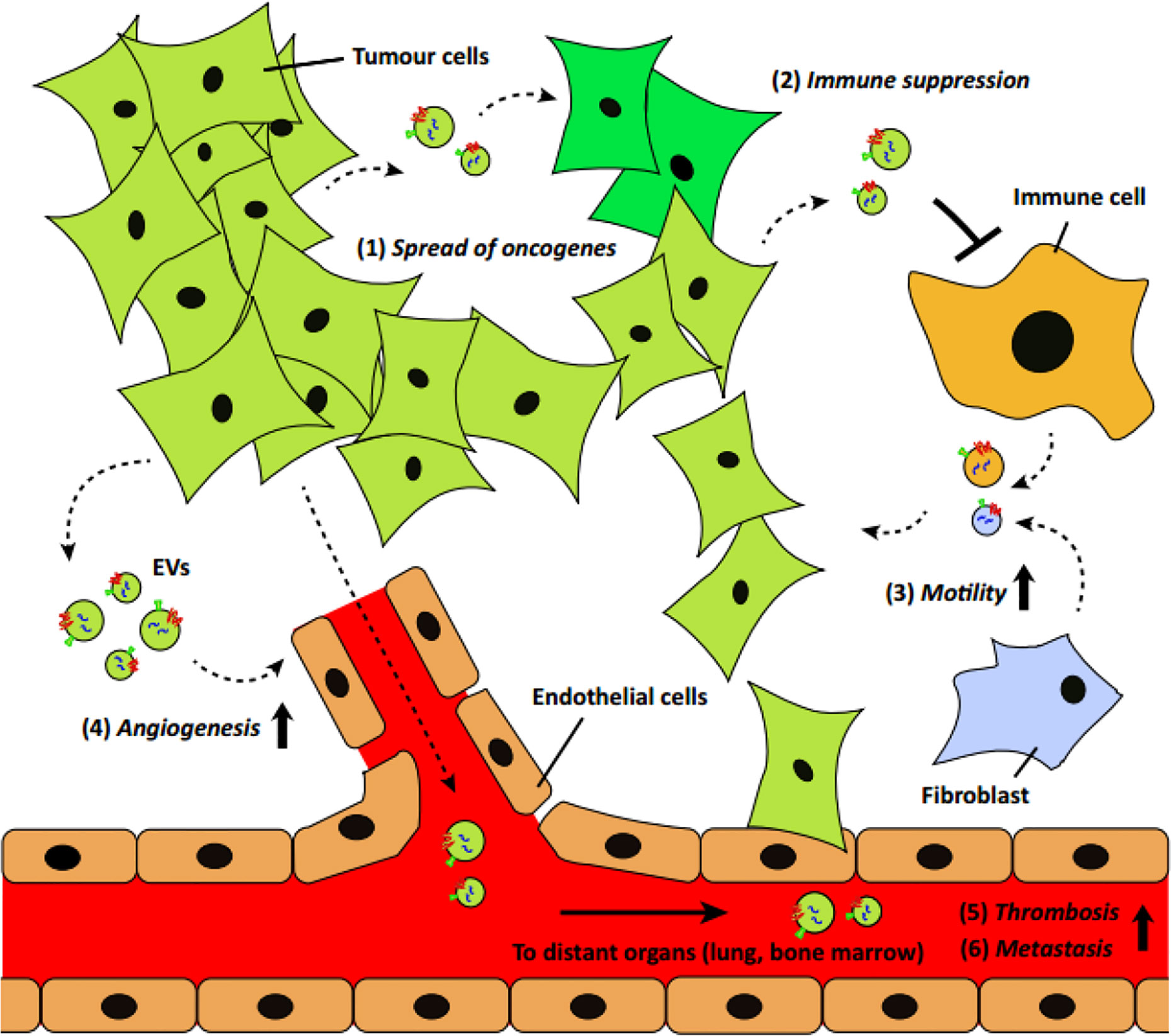 mesothelioma ucsf