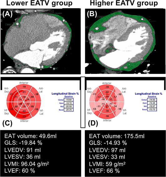 Global Longitudinal Strain and Global Circumferential Strain by  Speckle-Tracking Echocardiography and Feature-Tracking Cardiac Magnetic  Resonance Imaging: Comparison with Left Ventricular Ejection Fraction -  ScienceDirect