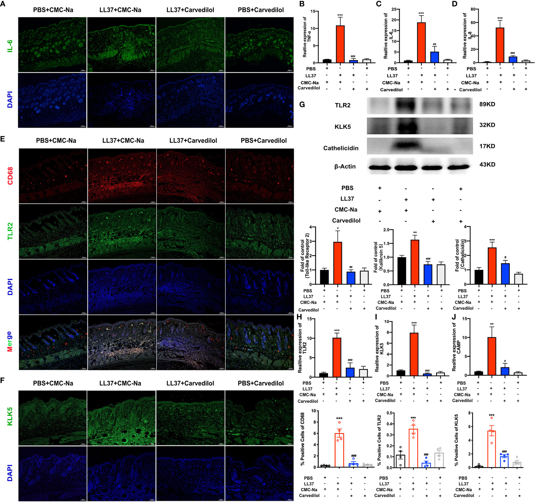 Frontiers | A Novel Mechanism of Carvedilol Efficacy for Rosacea ...