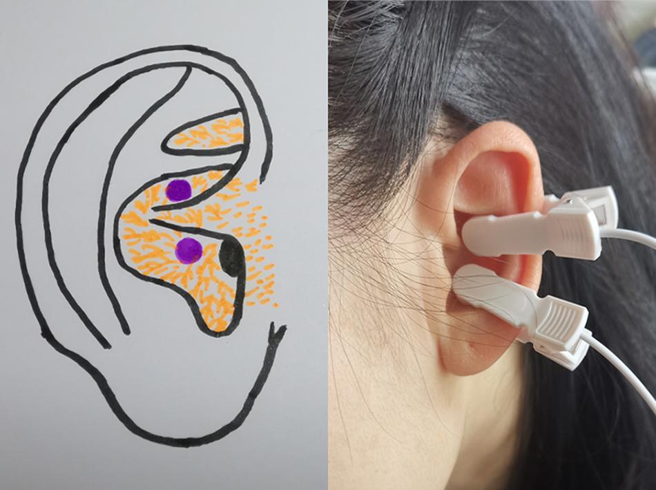 The vagus afferent network: emerging role in translational connectomics in:  Neurosurgical Focus Volume 45 Issue 3 (2018) Journals