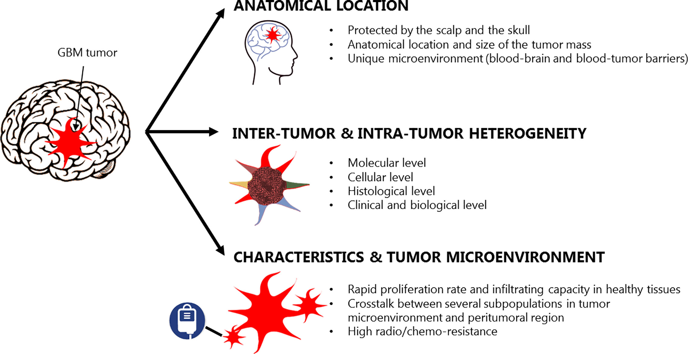 new research on glioblastoma