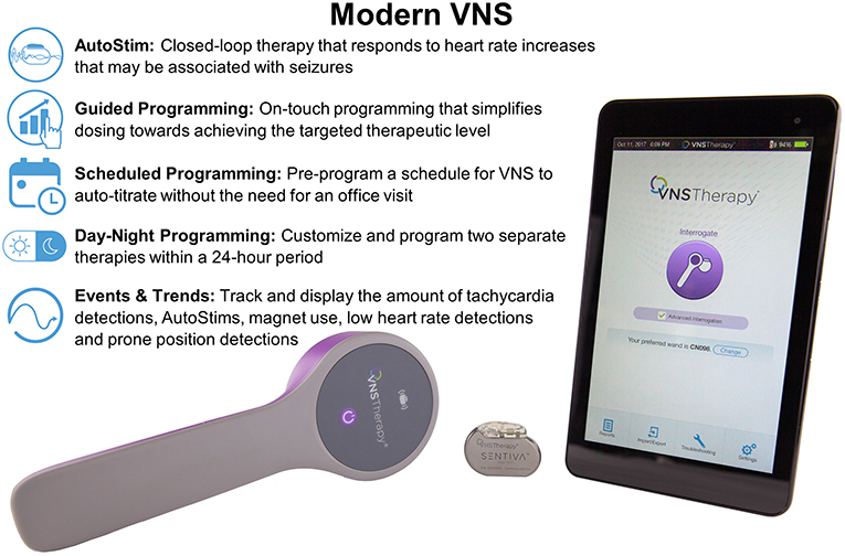 Frontiers | Responsive Vagus Nerve Stimulation for Drug Resistant