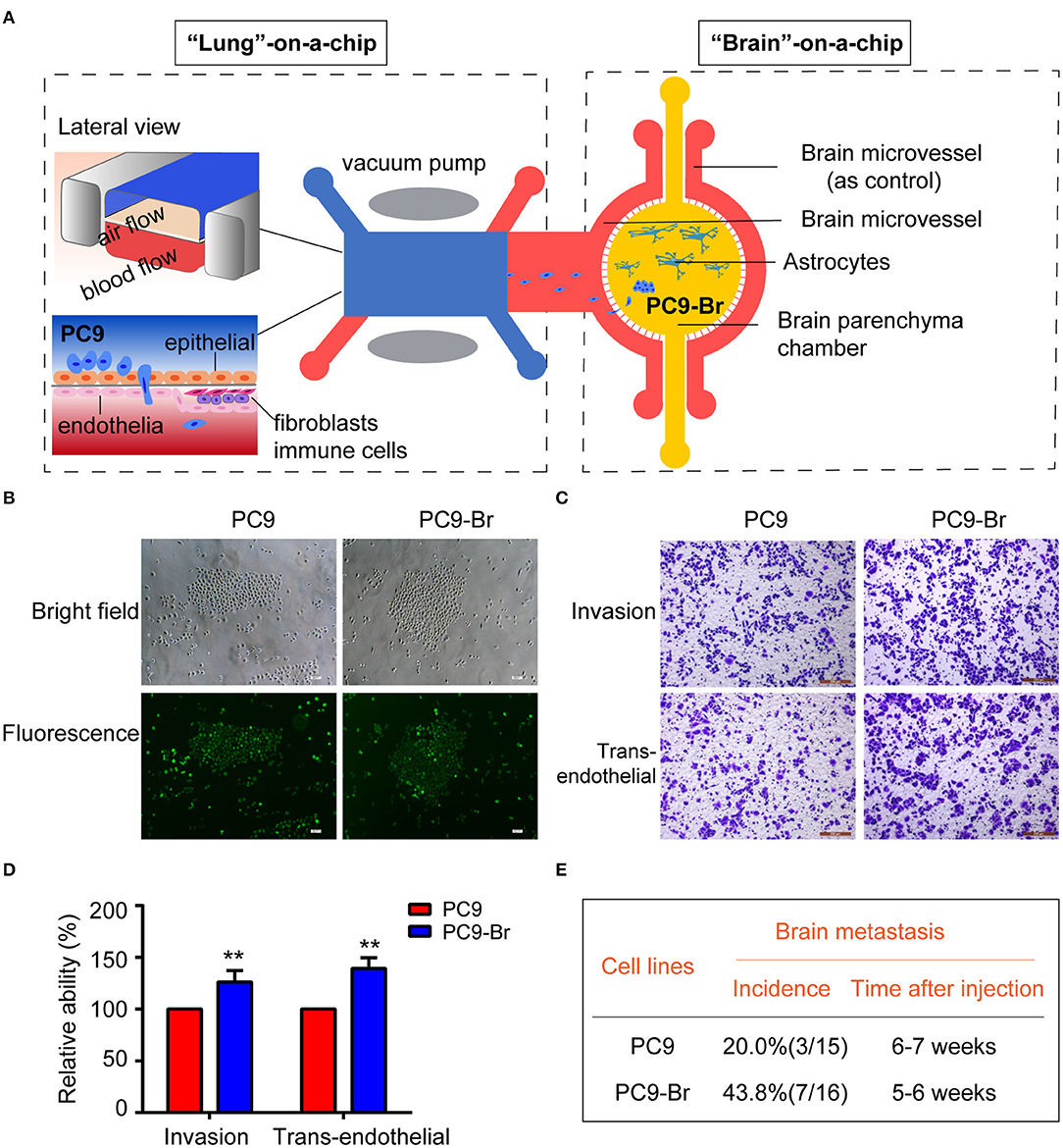 Frontiers  Proteomic Reveals Reasons for Acquired Drug Resistance in Lung  Cancer Derived Brain Metastasis Based on a Newly Established Multi-Organ  Microfluidic Chip Model