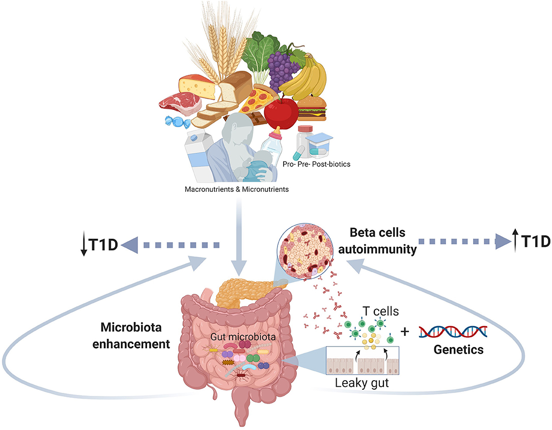 Frontiers Early Nutrition And Risk Of Type 1 Diabetes The Role Of