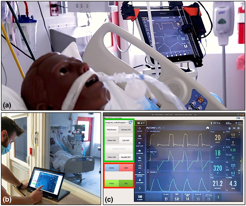 Medtronic deploys remote-controlled ventilators to lessen coronavirus  exposure