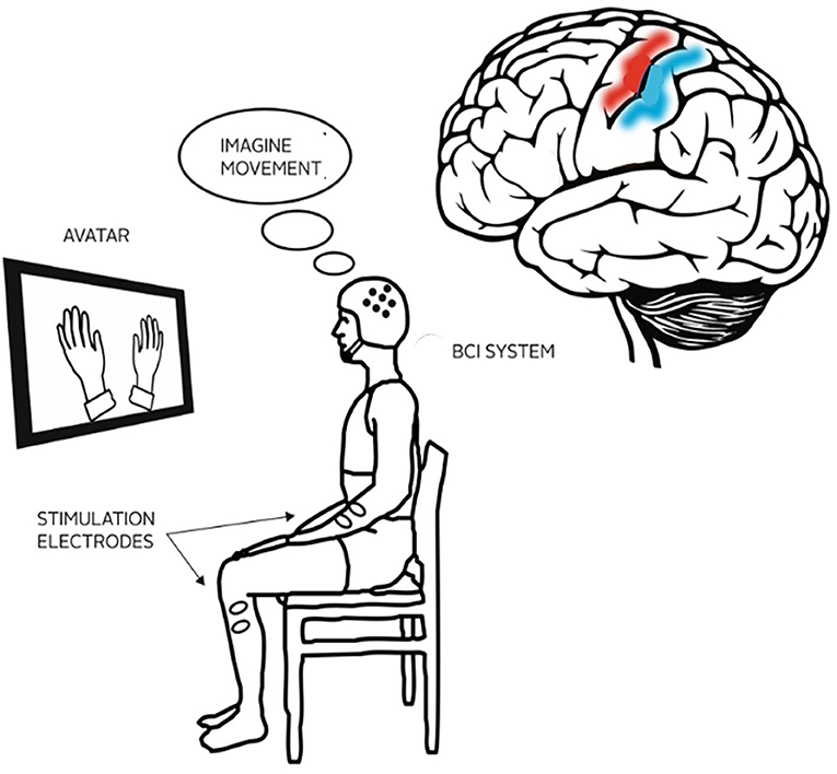 Figure 1 - In BCI therapy, stroke patients wear an electrode cap and view a monitor where an image, such as moving hands, helps them relearn how to move.