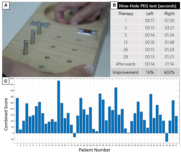 Figure 3 - (A) The Nine-Hole Peg Test can be used to test wrist and hand movement.