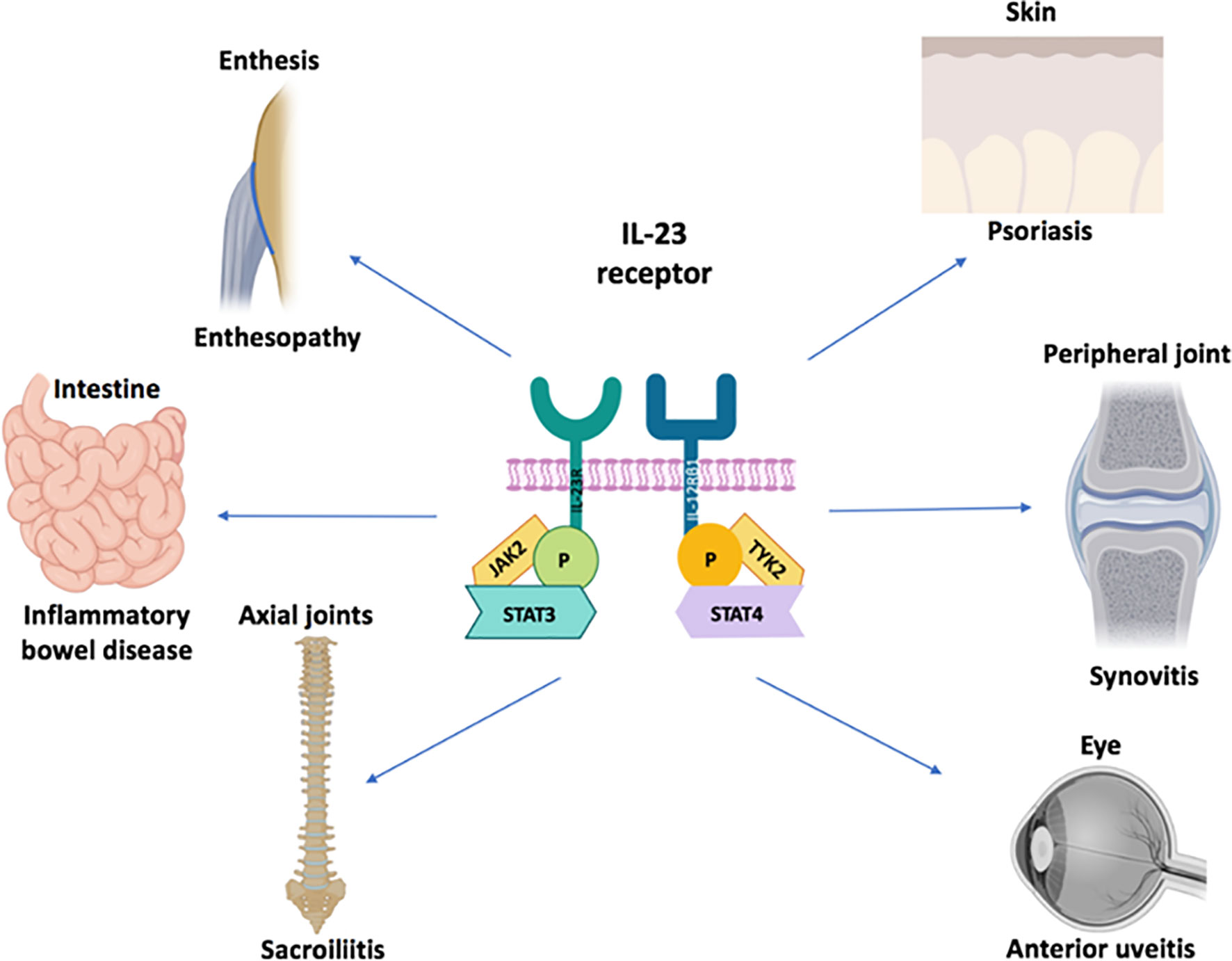 Frontiers Why Inhibition Of Il 23 Lacked Efficacy In Ankylosing Spondylitis Immunology