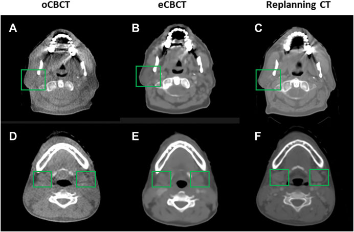 Powerful scans with world-class clinical measurements to enhance