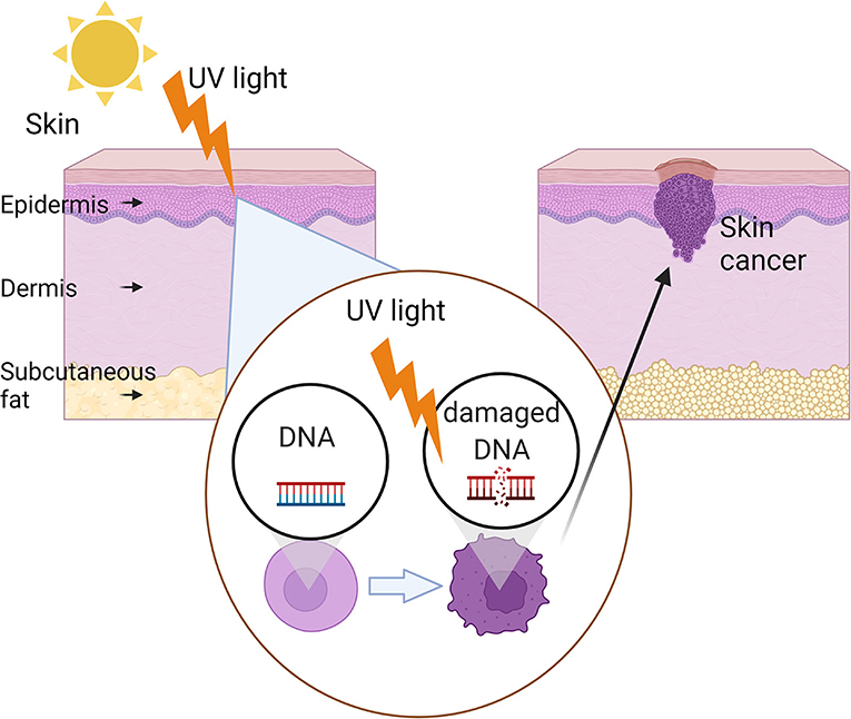 Figure 2 - How sun exposure leads to skin cancer.