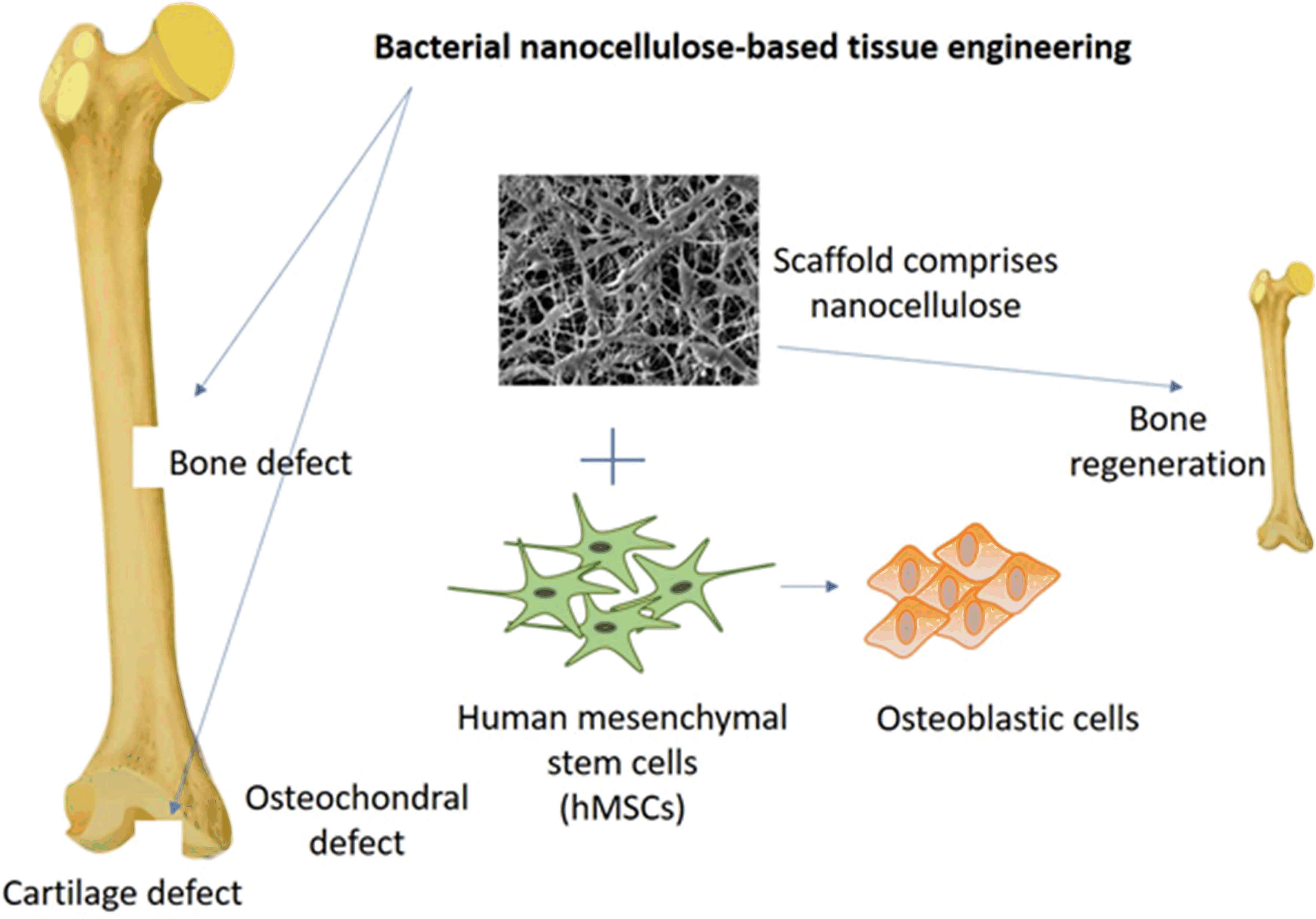 Frontiers Perspective Applications And Associated Challenges Of Using Nanocellulose In Treating Bone Related Diseases Bioengineering And Biotechnology