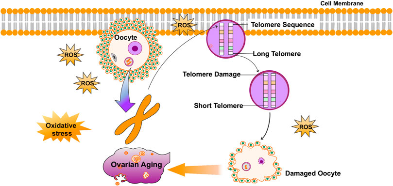 Oxidative Stress: A Pathogenic Mechanism for Niemann-Pick Type C