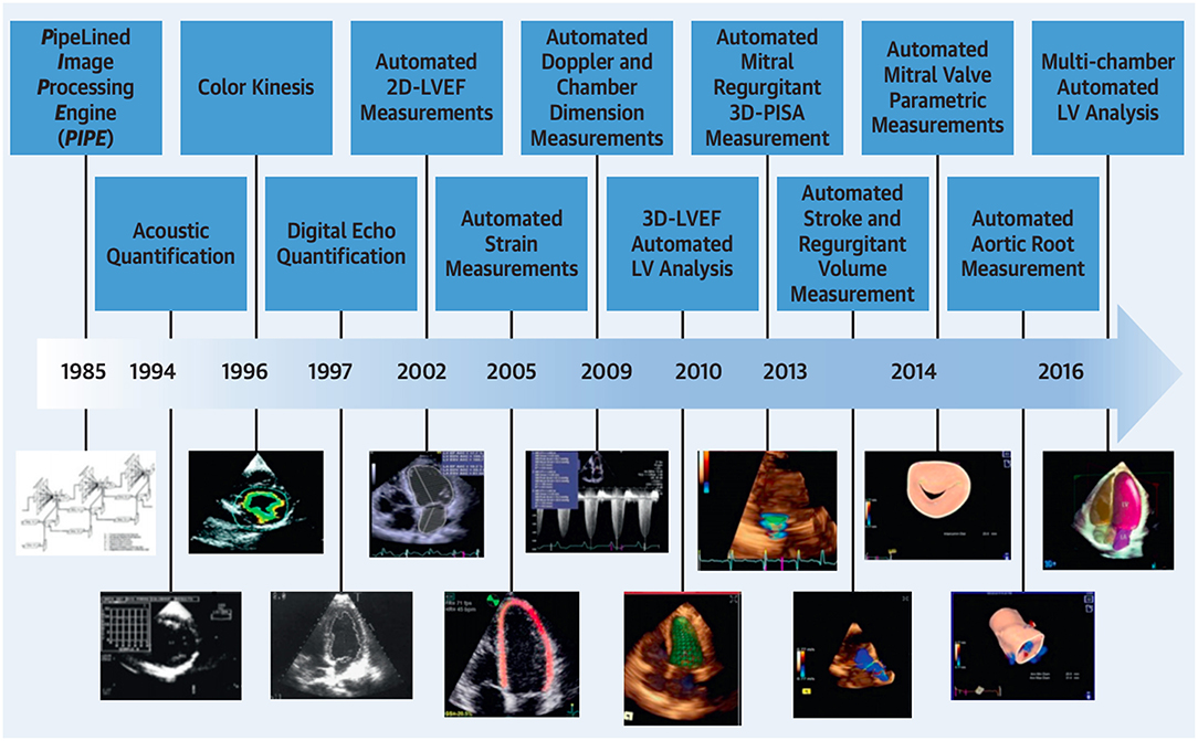 Asymptomatic left ventricular dysfunction : Study uses AI to create early  detector of heart disease 