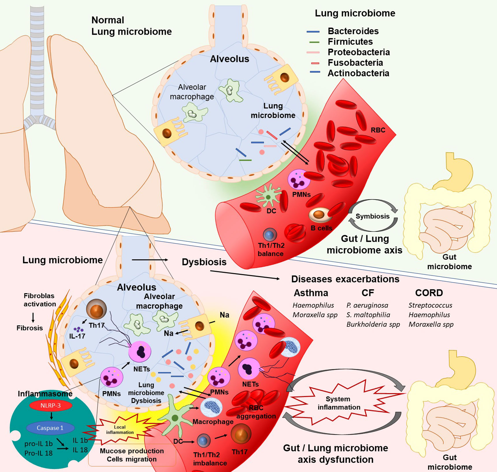 Taming Staphylococcus aureus in the eczema skin microbiome