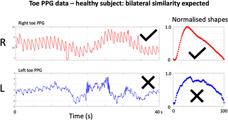 free download motion pulse signal