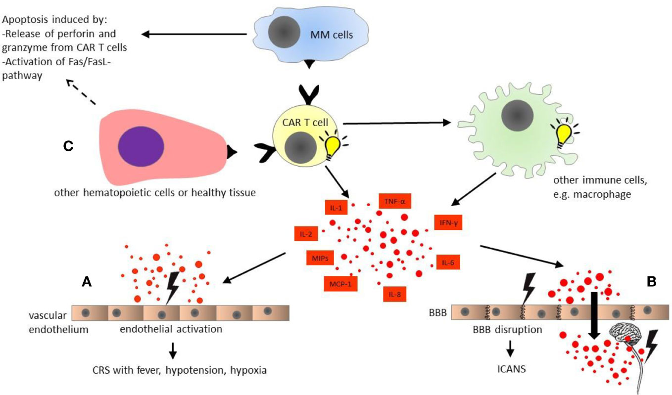 sbrt mesothelioma