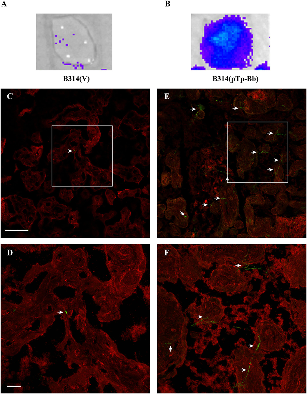 Frontiers  Identification and Functional Assessment of the First Placental  Adhesin of Treponema pallidum That May Play Critical Role in Congenital  Syphilis