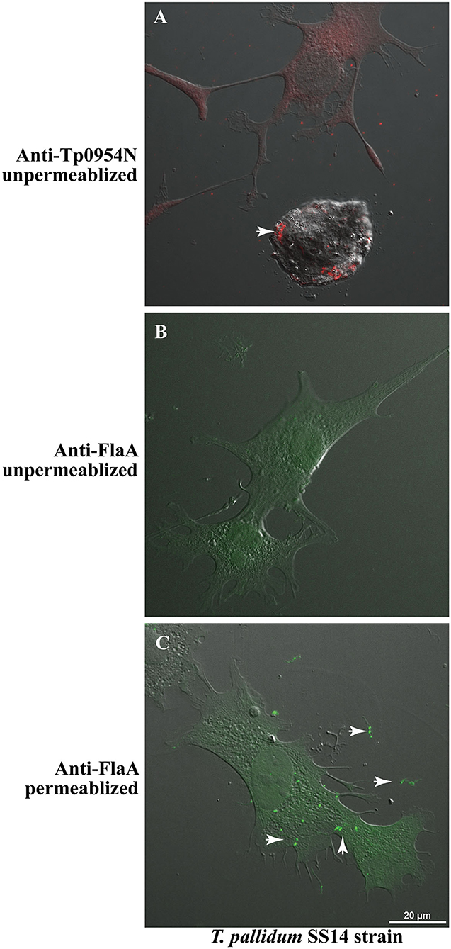 Frontiers  Identification and Functional Assessment of the First Placental  Adhesin of Treponema pallidum That May Play Critical Role in Congenital  Syphilis