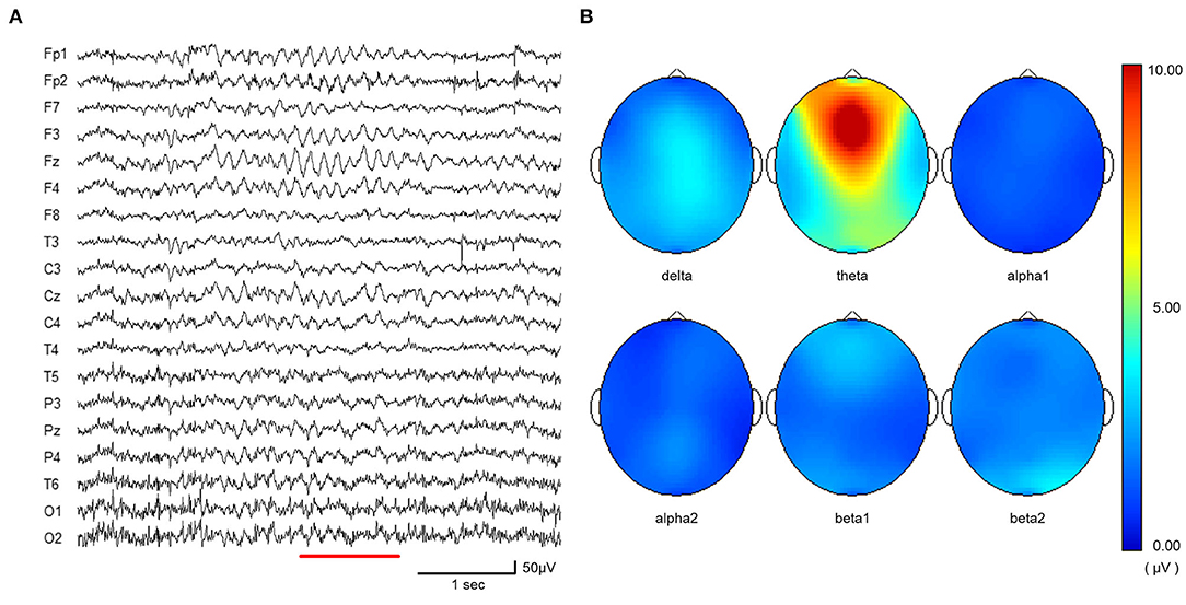 Frontiers | Changes in Electroencephalography and Cardiac Autonomic ...