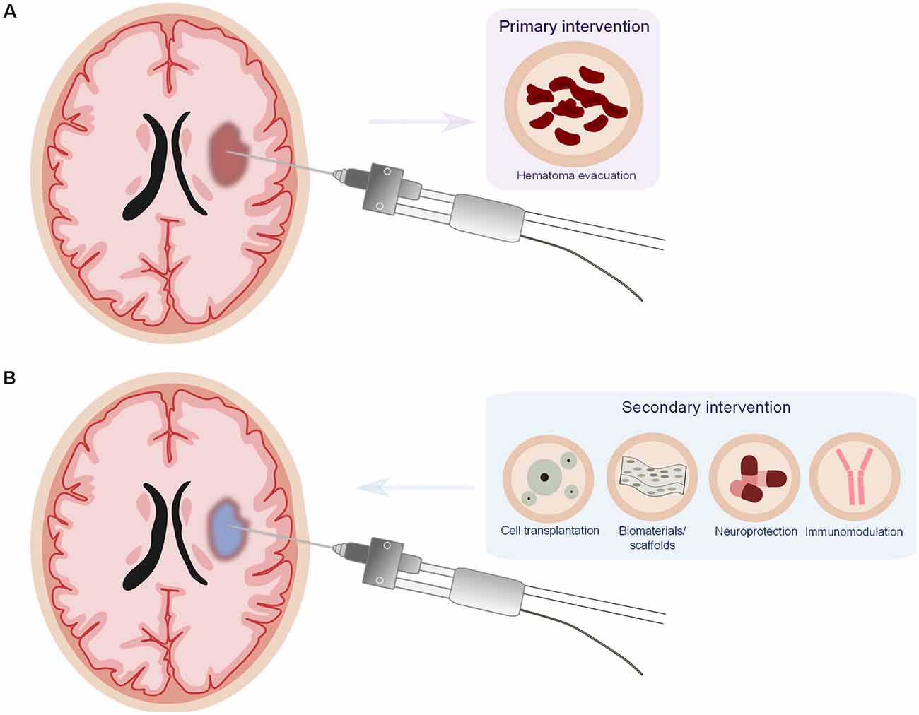 licens tapperhed I mængde Frontiers | New Mechanistic Insights, Novel Treatment Paradigms, and  Clinical Progress in Cerebrovascular Diseases | Aging Neuroscience
