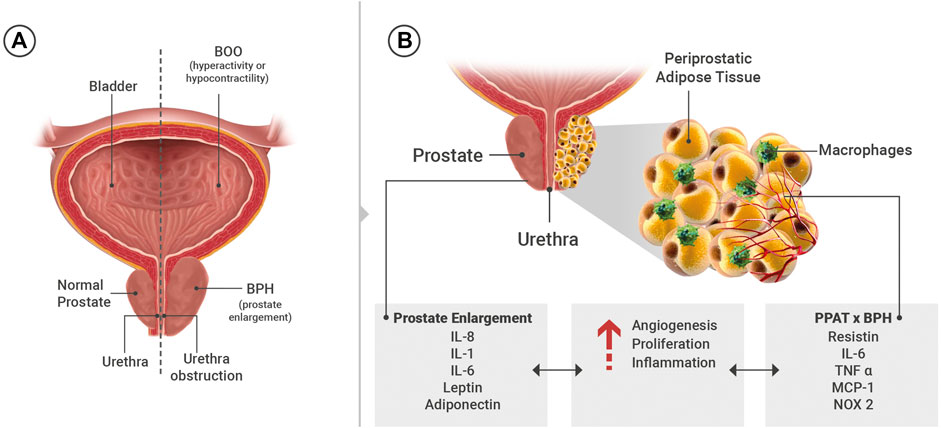 A prostatitis szó jelentése