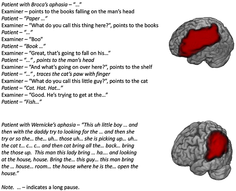 Figure 2 - Descriptions of the picture in Figure 1, provided by two patients with different (Broca’s and Wernicke’s) types of aphasia.