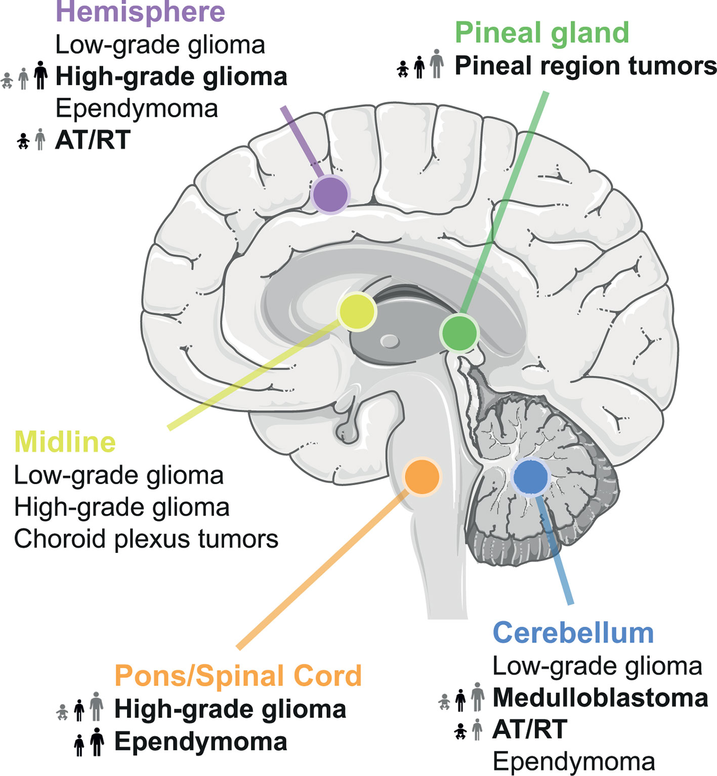 Grades Of Brain Tumors