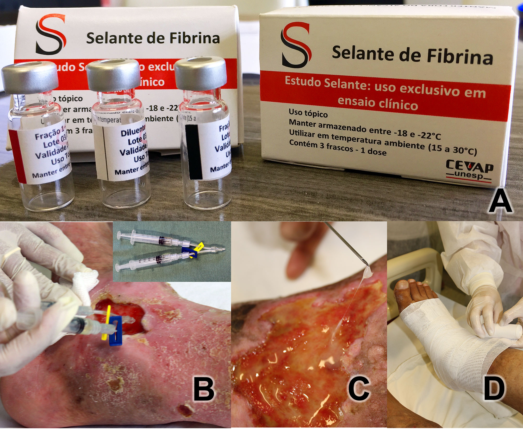 Morphological comparison of fibrin glue, CPAA glue, and suture in the