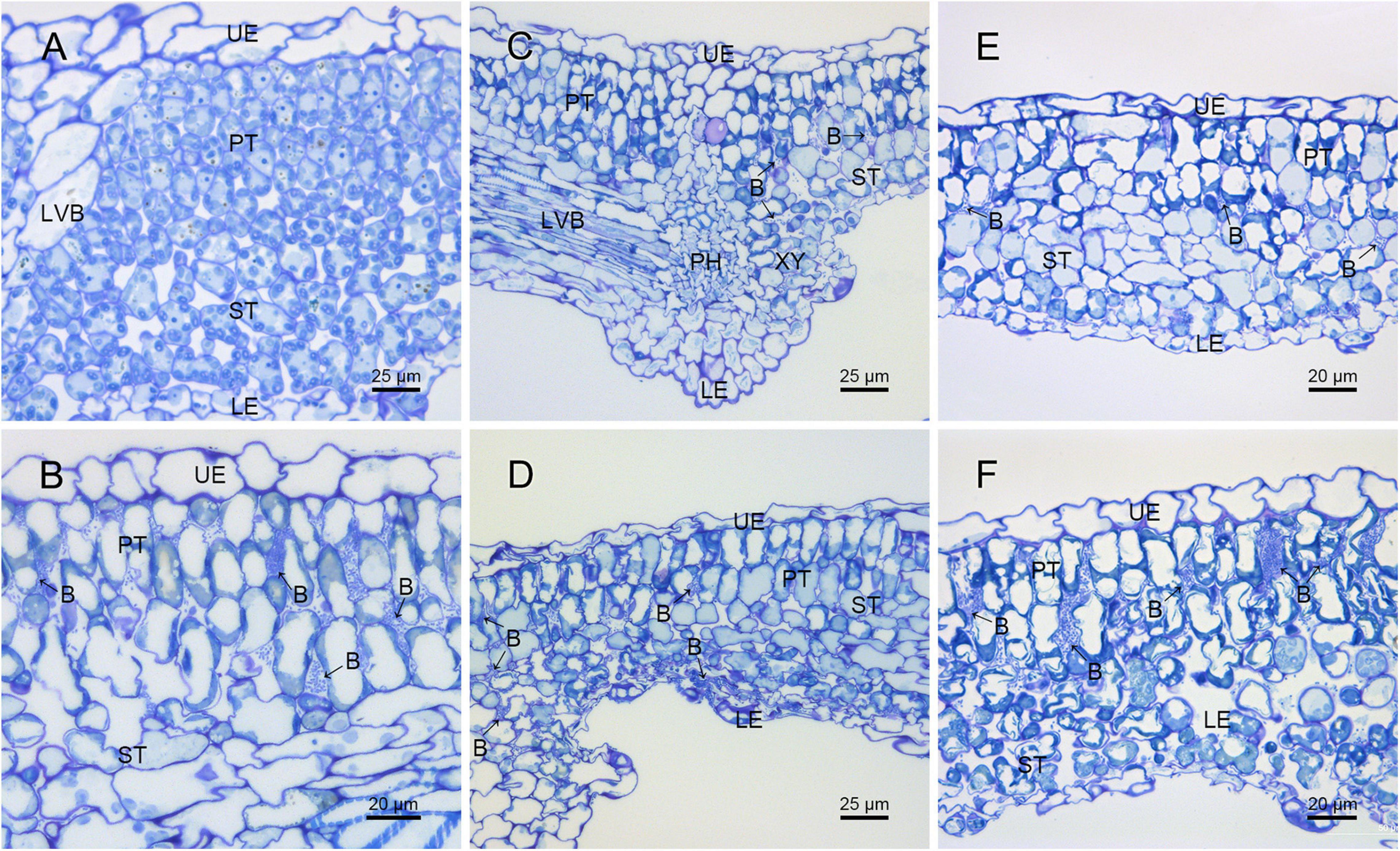 Frontiers | Role of the Type VI Secretion System in the Pathogenicity ...